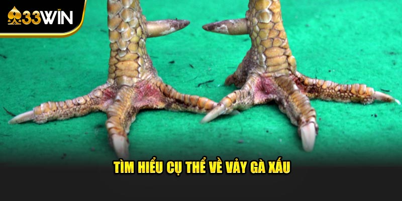 Tìm hiểu cụ thể về vảy gà xấu